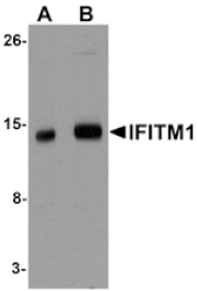 Western blot - IFITM1 Antibody from Signalway Antibody (25136) - Antibodies.com