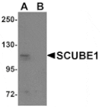 Western blot - SCUBE1 Antibody from Signalway Antibody (25152) - Antibodies.com