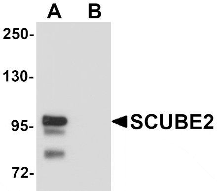 Western blot - SCUBE2 Antibody from Signalway Antibody (25153) - Antibodies.com