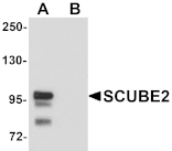 Western blot - SCUBE2 Antibody from Signalway Antibody (25153) - Antibodies.com