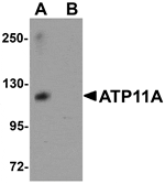 Western blot analysis of ATP11A in K562 cell tissue lysate with ATP11A antibody at 1 µg/mL in (A) the absence and (B) the presence of blocking peptide.