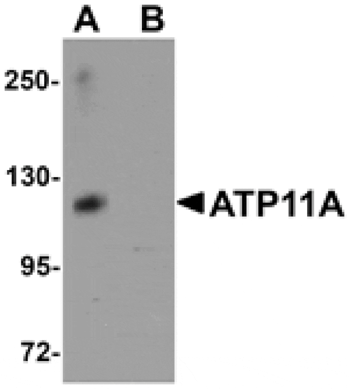 Western blot - ATP11A Antibody from Signalway Antibody (25157) - Antibodies.com