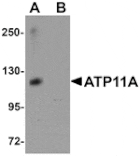 Western blot - ATP11A Antibody from Signalway Antibody (25157) - Antibodies.com