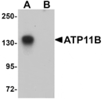 Western blot - ATP11B Antibody from Signalway Antibody (25158) - Antibodies.com