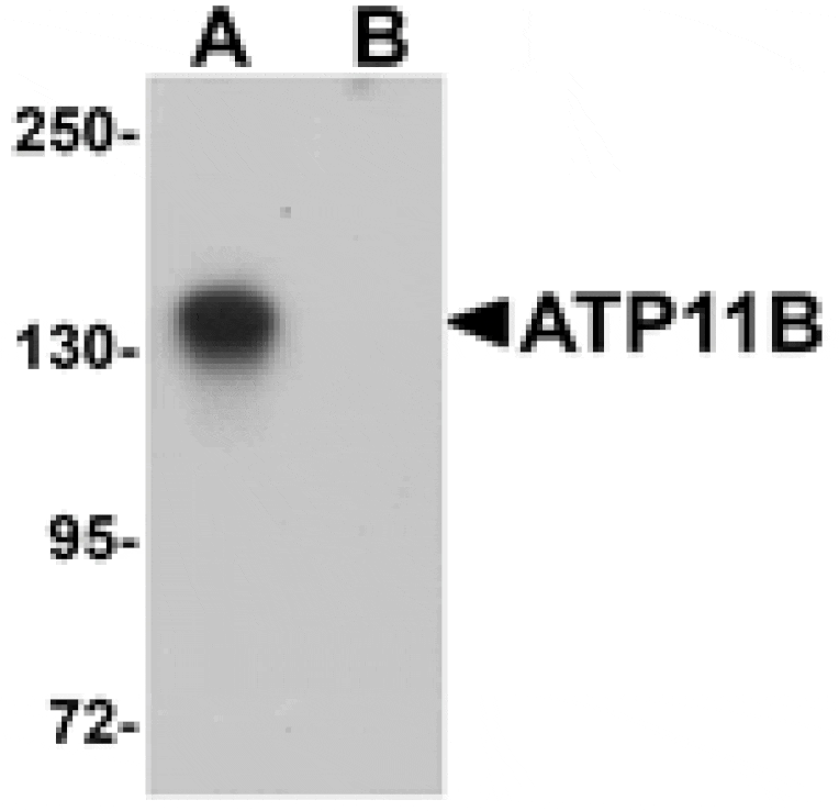 Western blot - ATP11B Antibody from Signalway Antibody (25158) - Antibodies.com