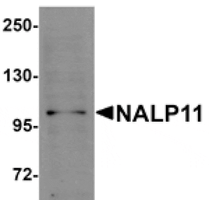 Western blot - NALP11 Antibody from Signalway Antibody (25185) - Antibodies.com