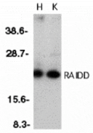 Western blot - RAIDD Antibody from Signalway Antibody (24010) - Antibodies.com