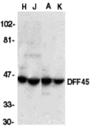 Western blot - DFF45 Antibody from Signalway Antibody (24023) - Antibodies.com