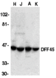 Western blot - DFF45 Antibody from Signalway Antibody (24023) - Antibodies.com