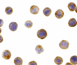 Immunocytochemistry - DFF45 Antibody from Signalway Antibody (24023) - Antibodies.com