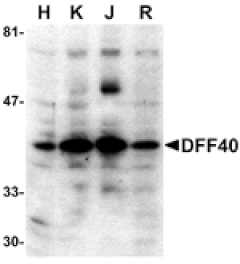 Western blot - DFF40 Antibody from Signalway Antibody (24060) - Antibodies.com