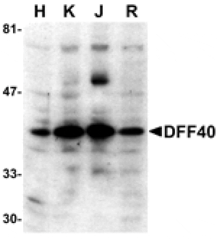 Western blot - DFF40 Antibody from Signalway Antibody (24060) - Antibodies.com