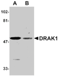 Western blot - DRAK1 Antibody from Signalway Antibody (24073) - Antibodies.com