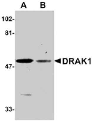 Western blot - DRAK1 Antibody from Signalway Antibody (24073) - Antibodies.com