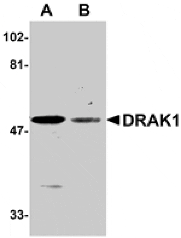 Western blot - DRAK1 Antibody from Signalway Antibody (24073) - Antibodies.com