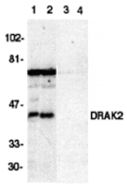 Western blot - DRAK2 Antibody from Signalway Antibody (24074) - Antibodies.com