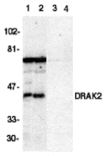 Western blot - DRAK2 Antibody from Signalway Antibody (24074) - Antibodies.com