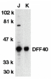 Western blot - DFF40 Antibody from Signalway Antibody (24075) - Antibodies.com
