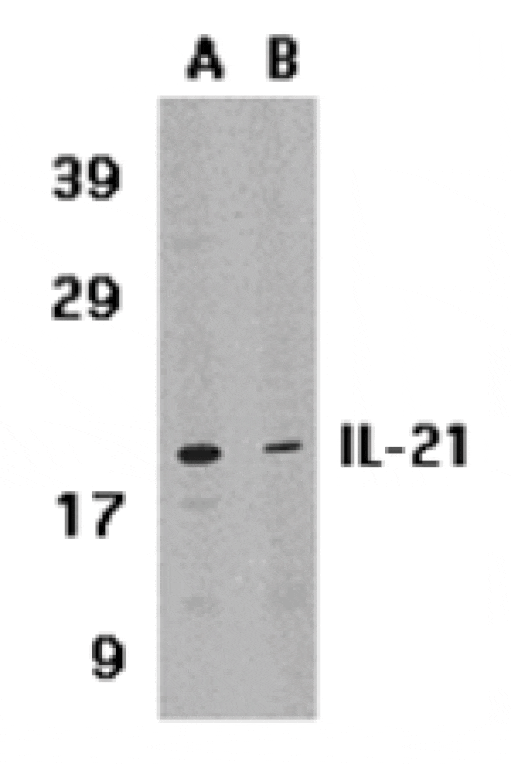 Western blot - IL-21 Antibody from Signalway Antibody (24143) - Antibodies.com