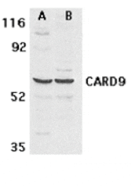 Western blot - CARD9 Antibody from Signalway Antibody (24160) - Antibodies.com