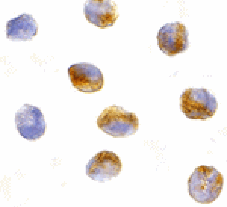 Immunocytochemistry - CARD9 Antibody from Signalway Antibody (24160) - Antibodies.com