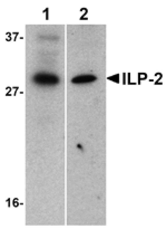 Western blot - ILP-2 Antibody from Signalway Antibody (24166) - Antibodies.com