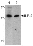 Western blot - ILP-2 Antibody from Signalway Antibody (24166) - Antibodies.com