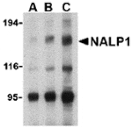 Western blot - NALP1 Antibody from Signalway Antibody (24173) - Antibodies.com