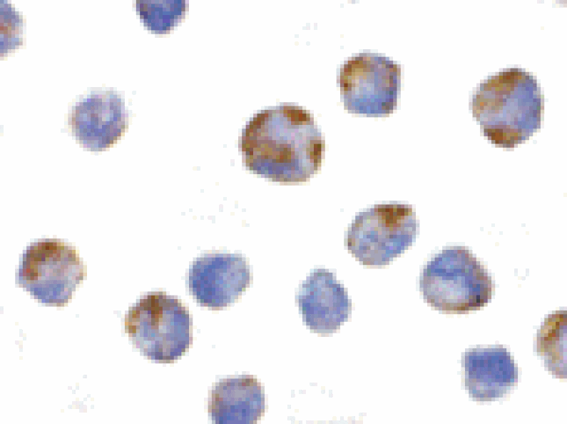 Immunocytochemistry - NALP1 Antibody from Signalway Antibody (24173) - Antibodies.com