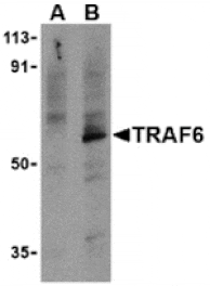 Western blot - TRAF6 Antibody from Signalway Antibody (24191) - Antibodies.com