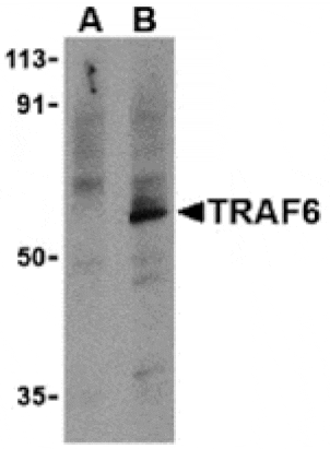 Western blot - TRAF6 Antibody from Signalway Antibody (24191) - Antibodies.com