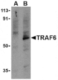 Western blot - TRAF6 Antibody from Signalway Antibody (24191) - Antibodies.com