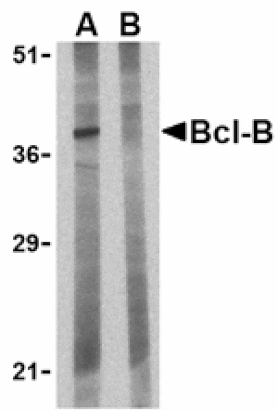 Western blot - Bcl-B Antibody from Signalway Antibody (24202) - Antibodies.com