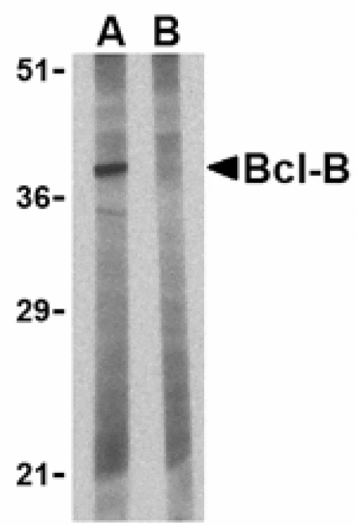 Western blot - Bcl-B Antibody from Signalway Antibody (24202) - Antibodies.com