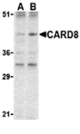 Western blot - CARD8 Antibody from Signalway Antibody (24206) - Antibodies.com