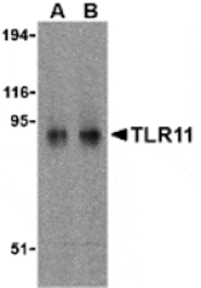 Western blot - TLR11 Antibody from Signalway Antibody (24231) - Antibodies.com