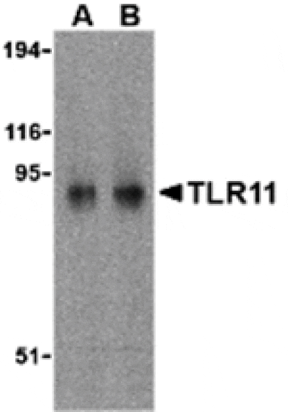 Western blot - TLR11 Antibody from Signalway Antibody (24231) - Antibodies.com