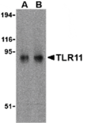 Western blot - TLR11 Antibody from Signalway Antibody (24231) - Antibodies.com