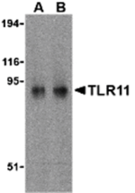 Western blot - TLR11 Antibody from Signalway Antibody (24231) - Antibodies.com