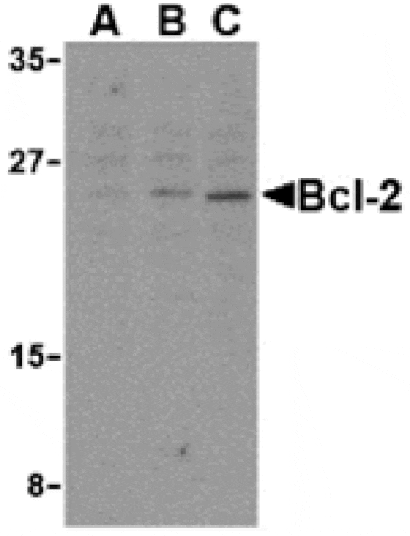 Western blot - Bcl-2 Antibody from Signalway Antibody (24246) - Antibodies.com