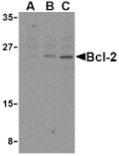 Western blot - Bcl-2 Antibody from Signalway Antibody (24246) - Antibodies.com