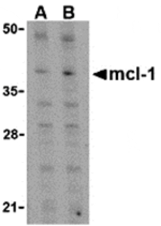 Western blot - Mcl-1 Antibody from Signalway Antibody (24298) - Antibodies.com