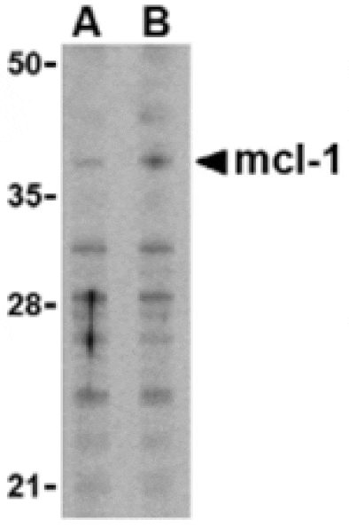 Western blot - Mcl-1 Antibody from Signalway Antibody (24299) - Antibodies.com