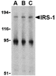 Western blot - IRS-1 Antibody from Signalway Antibody (24317) - Antibodies.com