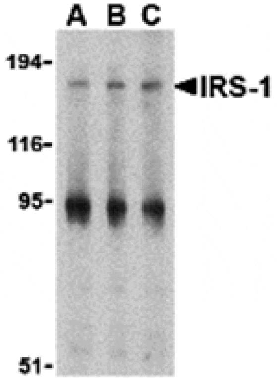 Western blot - IRS-1 Antibody from Signalway Antibody (24317) - Antibodies.com