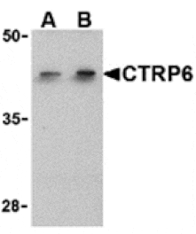 Western blot - CTRP6 Antibody from Signalway Antibody (24334) - Antibodies.com