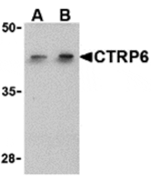 Western blot - CTRP6 Antibody from Signalway Antibody (24334) - Antibodies.com
