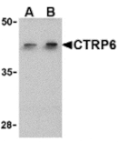 Western blot - CTRP6 Antibody from Signalway Antibody (24334) - Antibodies.com