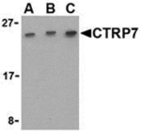 Western blot - CTRP7 Antibody from Signalway Antibody (24336) - Antibodies.com