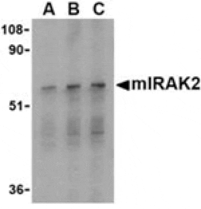 Western blot - IRAK2 Antibody from Signalway Antibody (24343) - Antibodies.com